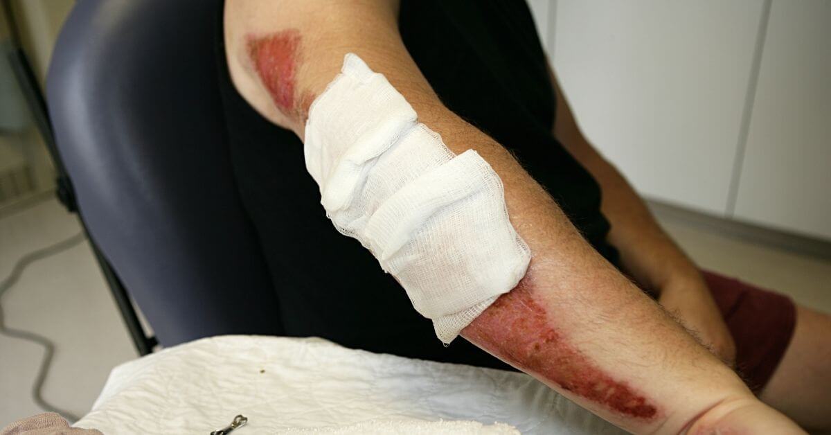 Injured Bandage, Right
