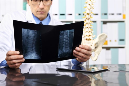 doctor expert witness looking at xray of spinal injury