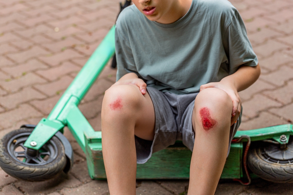 Common Scooter Accident Injuries